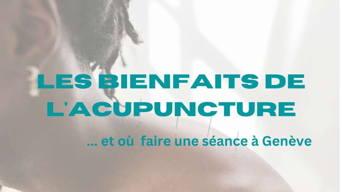 Acupuncture, ses bienfaits et où trouver un praticien à Genève ?