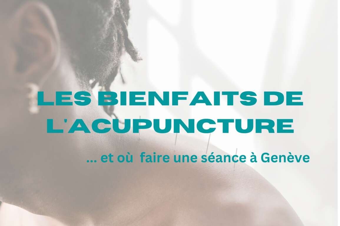 Acupuncture, ses bienfaits et où trouver un praticien à Genève ?